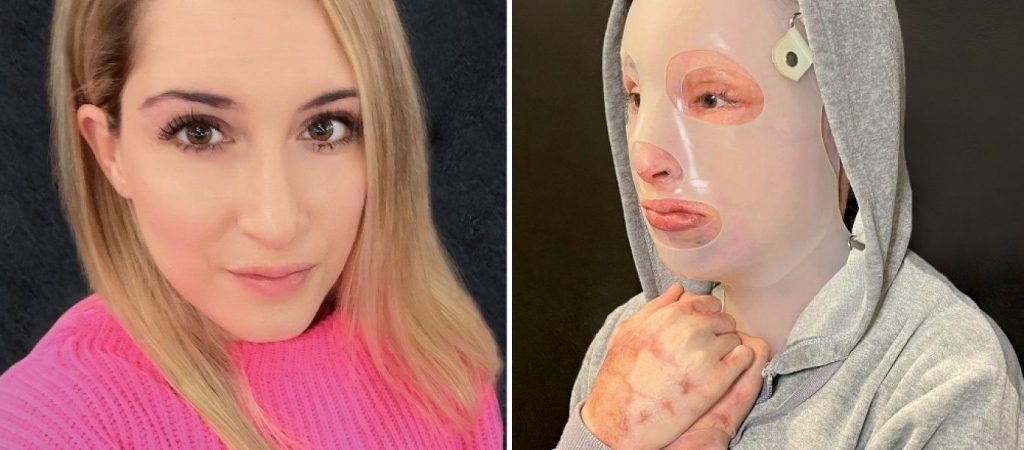 Επίθεση με βιτριόλι: «Θέλω να είμαι εκεί χωρίς να φοβάμαι» – Το μήνυμα της Ιωάννας ενόψει της δίκης