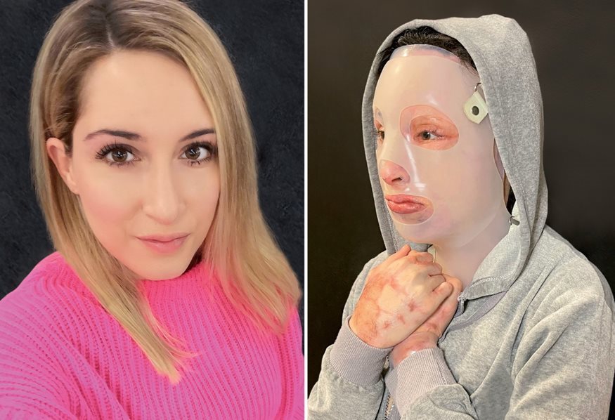 Επίθεση με βιτριόλι:  Ξεκινά αύριο η δίκη – Παρούσα η Ιωάννα Παλιοσπύρου