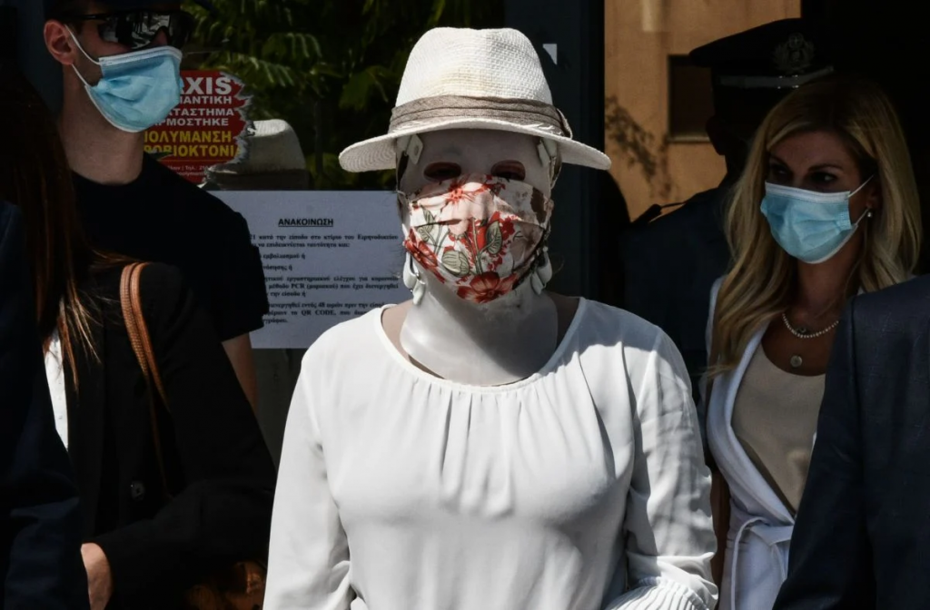 Οφθαλμίατρος Ιωάννας Παλιοσπύρου: «Τα τραύματά της θα πάνε καλά, αυτά στην ψυχή της θα κρατήσουν παραπάνω»