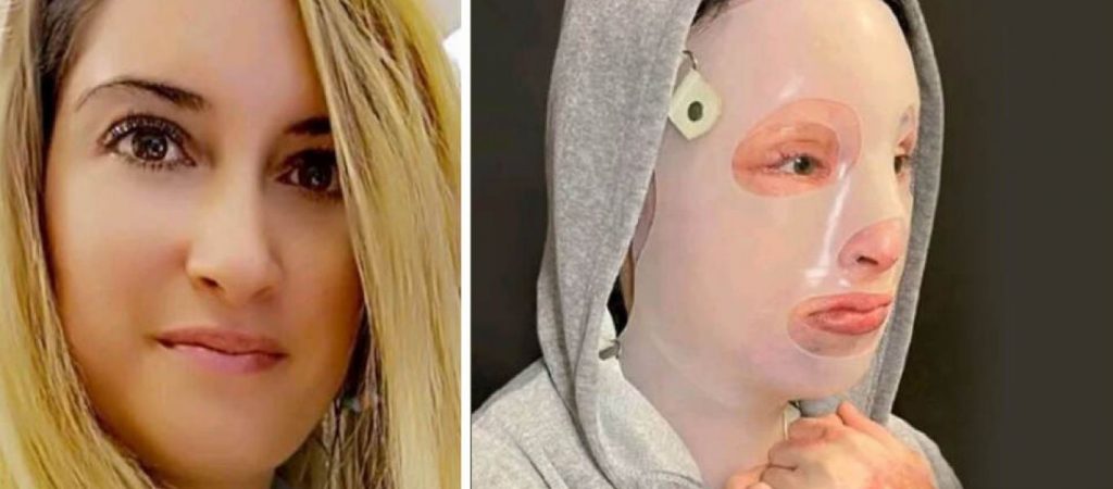 Επίθεση με βιτριόλι – Α.Λύτρας: «Η Ιωάννα έχει αποδεχθεί αυτήν τη νέα κατάσταση»