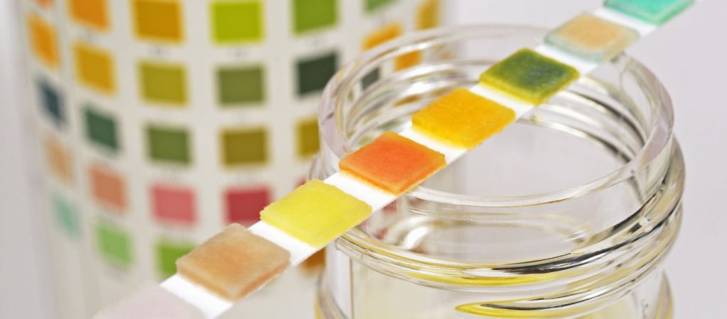 Δείτε τι φανερώνει για την υγεία το χρώμα που έχουν τα ούρα μας