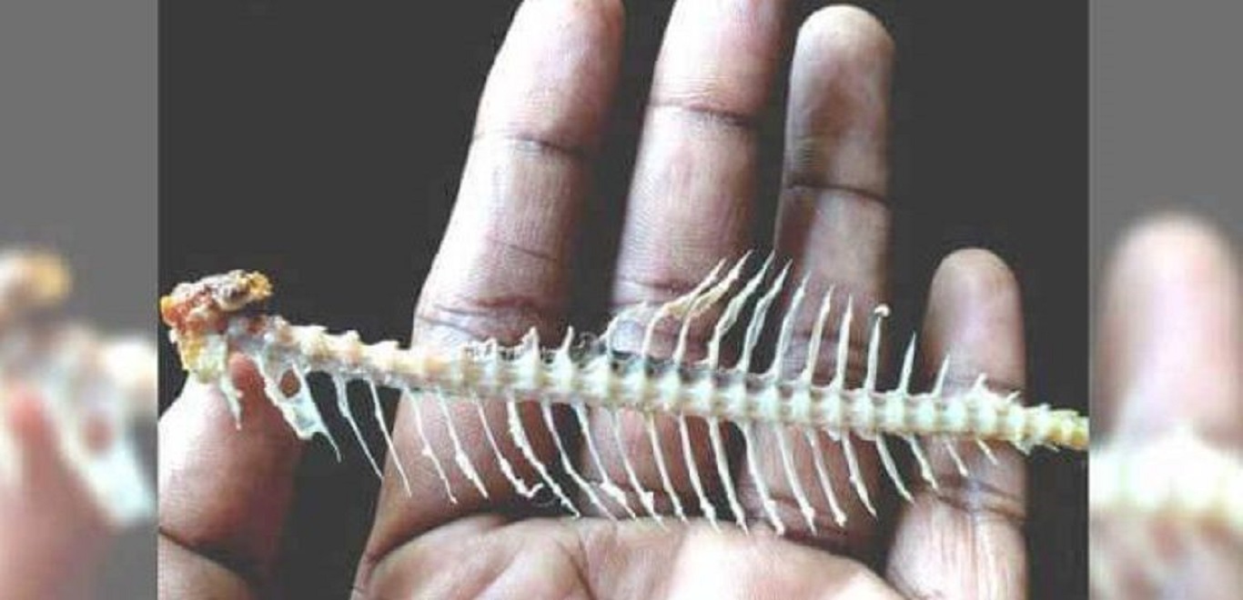 Δείτε τι πρέπει να κάνετε εάν κολλήσει κόκκαλο από ψάρι στο λαιμό σας