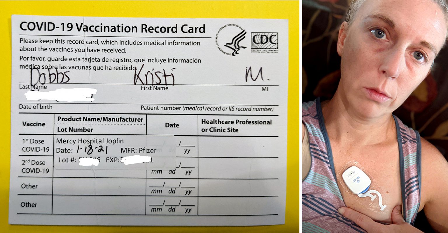 ΗΠΑ – 40χρονη οδοντίατρος συγκλονίζει: «Εμβολιάστηκα και πλέον δεν μπορώ να εργαστώ λόγω παρενεργειών»