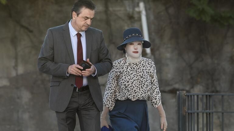 Επίθεση με βιτριόλι: «Τα εγκαύματα της Ιωάννας προκλήθηκαν από θερμοκρασία που έφτανε τους 400 βαθμούς» λέει γιατρός