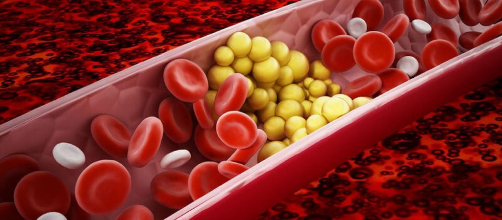 Δείτε ποιες είναι οι τροφές που «ρίχνουν» τη χοληστερίνη