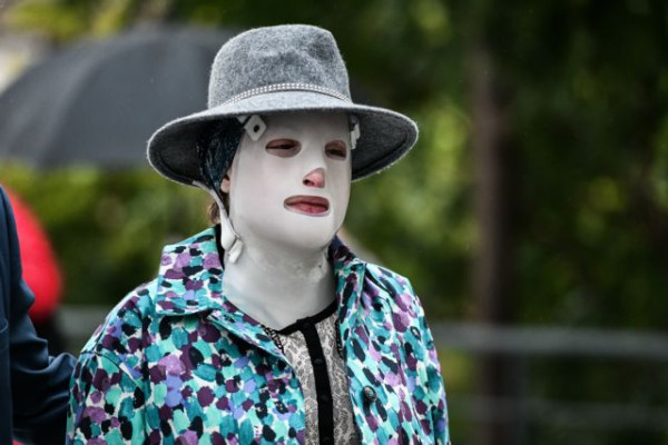 Βιτριόλι – Ι.Παλιοσπύρου: «Η 37χρονη είναι αμετανόητη – Της έδειξαν φωτογραφίες μου & έμεινε απαθής & ατάραχη»