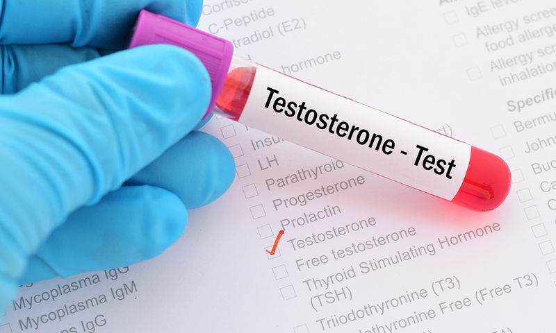 Νέα μελέτη υποστηρίζει: Η υψηλή τεστοστερόνη ωθεί τους άνδρες σε πολλές συντρόφους