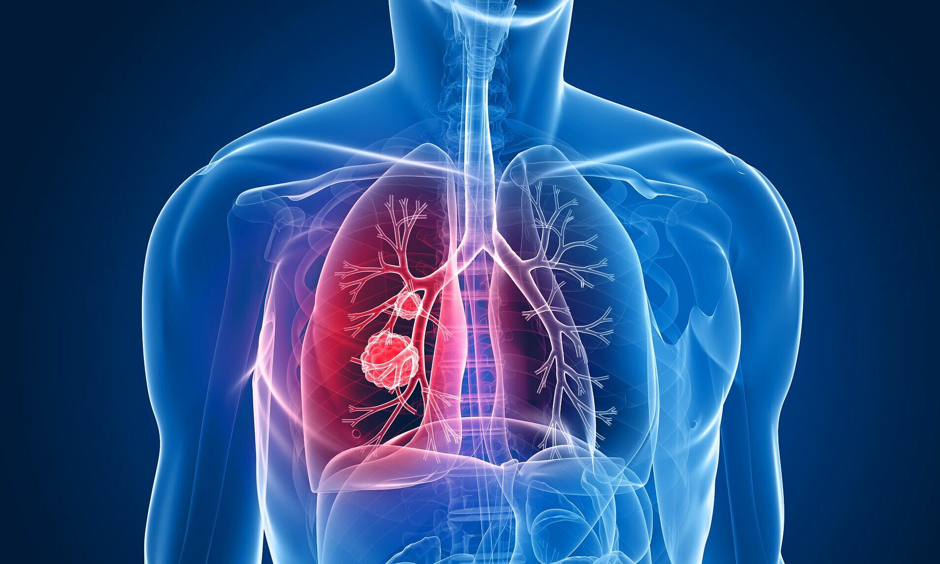 Πρόβλημα στους πνεύμονες: Πέντε πρώιμα σημάδια που δείχνουν ότι δεν λειτουργούν σωστά