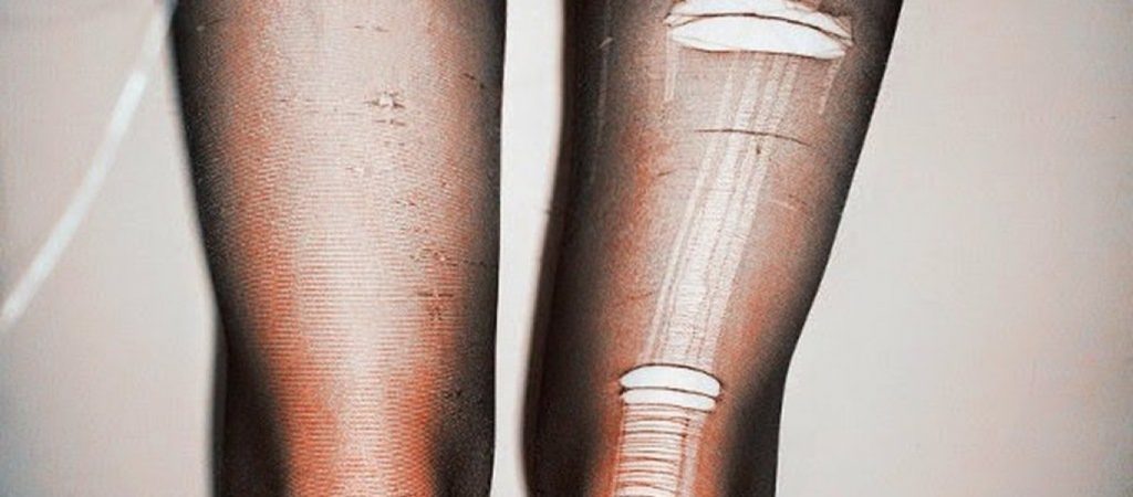 Οι 8+1 χρήσεις για το παλιό καλσόν – Δεν πάει ο νους σας!