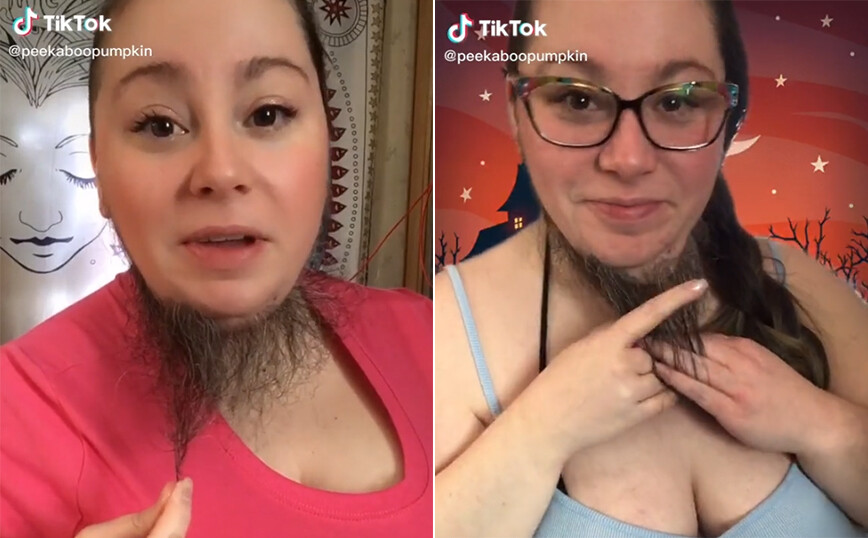 Περίεργα γούστα: Γυναίκα με… μούσι γίνεται ανάρπαστη σε σελίδες ερωτικού περιεχομένου! (βίντεο)