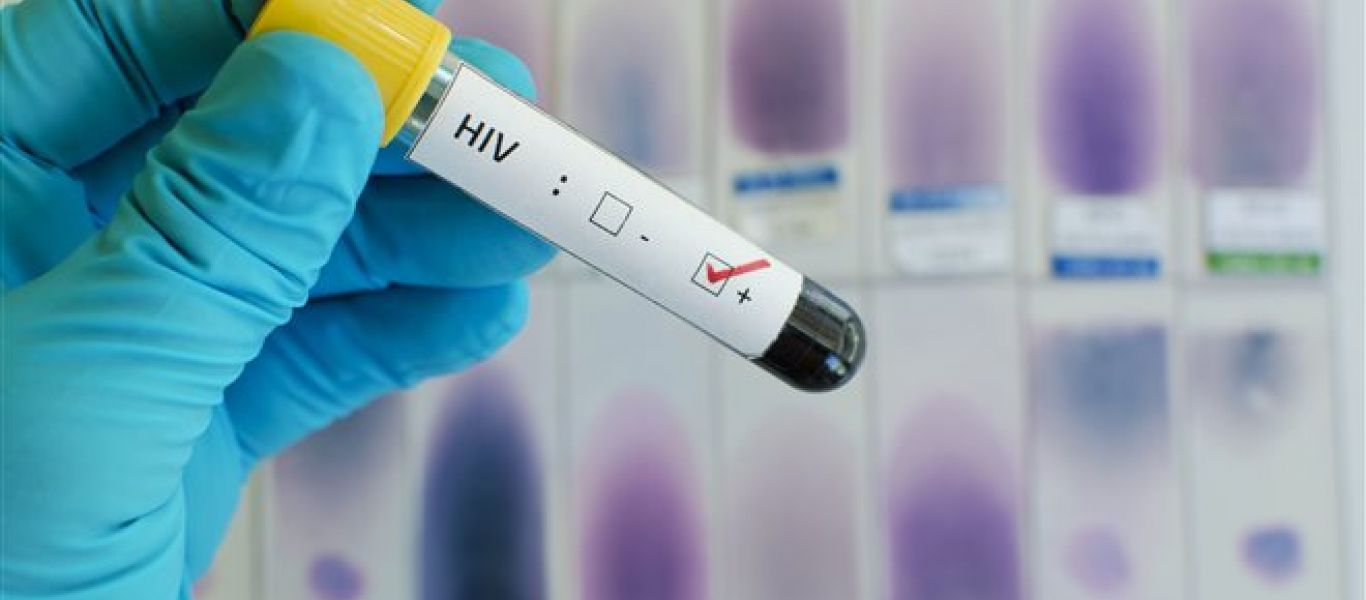 ΗΠΑ: Εντοπίστηκε δεύτερος ασθενής που φαίνεται να «ξεφορτώθηκε» τον ιό HIV με φυσικό τρόπο