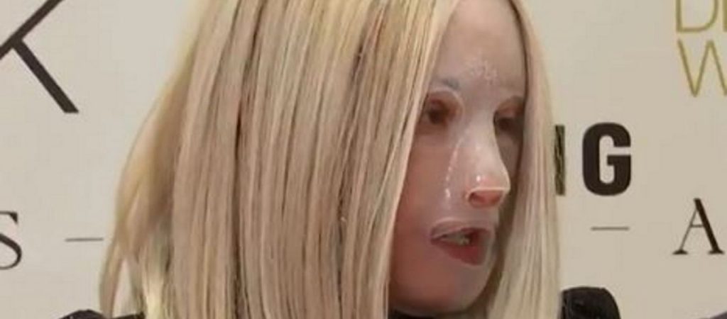 Ιωάννα Παλιοσπύρου: Έδειξα τα σημάδια στο σώμα της και τα λιωμένα ρούχα της από την ημέρα της επίθεσης με το βιτριόλι