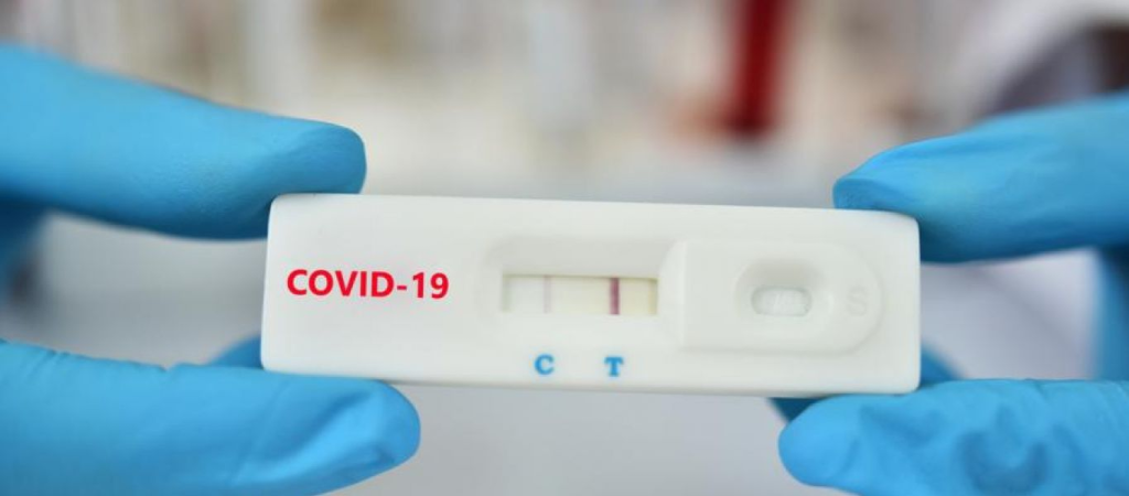 Νέα ιταλική μελέτη: Το 50% των γρήγορων rapid test κορωνοϊού παράγει λανθασμένο αποτέλεσμα
