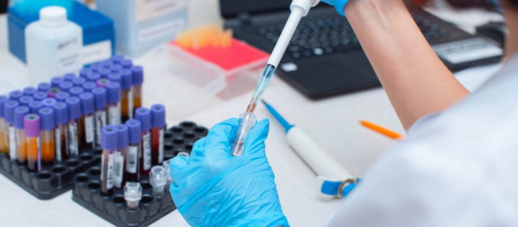 Νέα έρευνα υποστηρίζει: Κίνδυνος σοβαρής Covid-19 για τους διαβητικούς με ιστορικό κακής ρύθμισης του σακχάρου τους