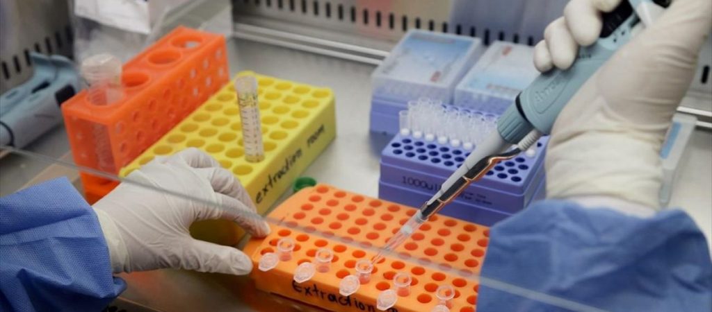 Μονοκλωνικά αντισώματα: Από την Παρασκευή η χορήγηση στην Ελλάδα – Ποιοι ασθενείς θα έχουν προτεραιότητα