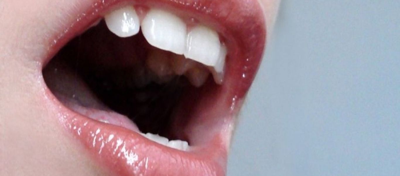 Καρκίνος στο στόμα: Συμπτώματα, αίτια και όλα όσα πρέπει να γνωρίζετε