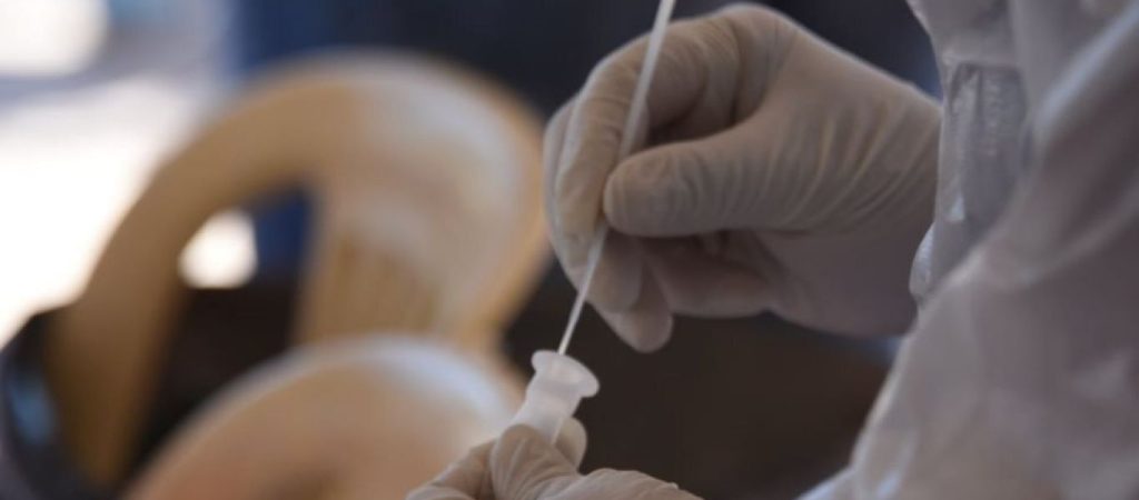 ΕΟΔΥ: Δείτε που θα πραγματοποιούνται δωρεάν rapid test σήμερα