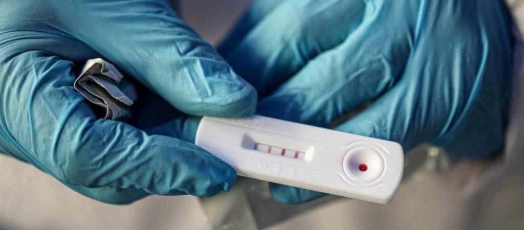ΕΟΔΥ: Δείτε που θα πραγματοποιούνται δωρεάν rapid test σήμερα