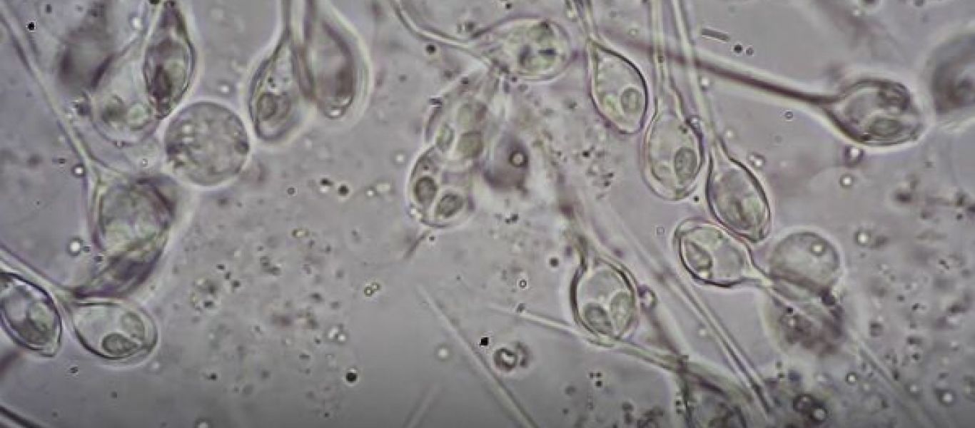 Επιβιώνει παντού: Ο μοναδικός οργανισμός που αντέχει χωρίς οξυγόνο