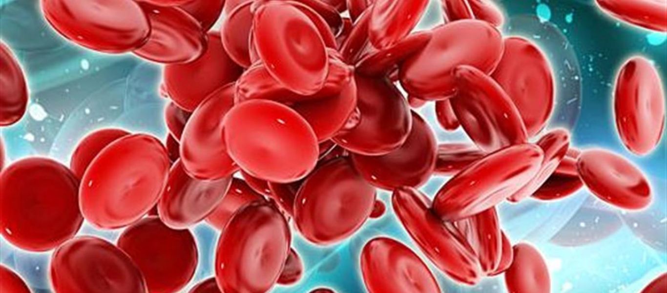 Σιδηροπενική αναιμία: Αυτά είναι τα συμπτώματα που δείχνουν ότι πάσχετε
