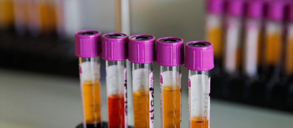 Νέες μελέτες: Η παραλλαγή Όμικρον του κορωνοϊού μπορεί να διαφύγει από την ανοσιακή προστασία των μονοκλωνικών