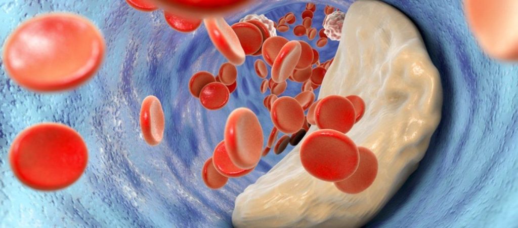 Τα 4+1 βήματα για τη μείωση της χοληστερίνης