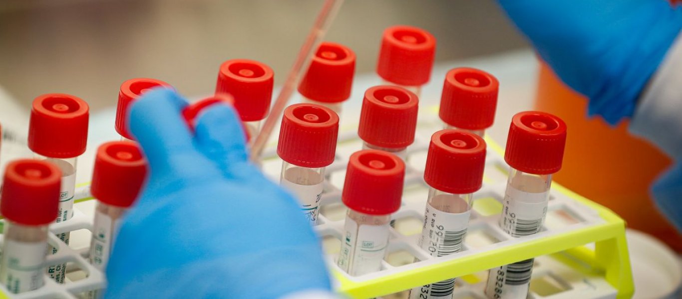 Β.Ανεμοδουρά: «Μέρος της διασποράς οφείλεται στον τρόπο που κάνουμε την ιχνηλάτηση – Θα κολλήσουμε όλοι»