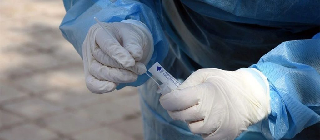 Rapid test: Νέα έρευνα «δείχνει» ότι 6 στα 10 είναι ψευδώς αρνητικά