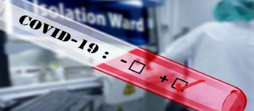 Στα 17.633 τα νέα κρούσματα – 61 θάνατοι και 626 διασωληνωμένοι