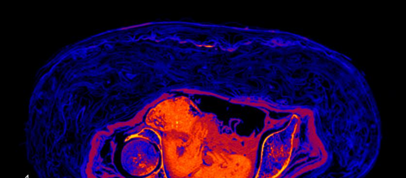 Πολωνοί επιστήμονες εντόπισαν Αιγύπτια έγκυο μούμια άνω των δυο χιλιάδων ετών