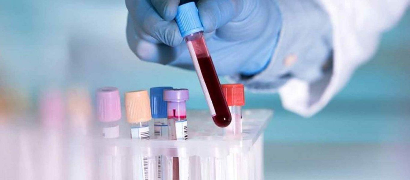 Βρετανία: Αναπτύχθηκε νέο τεστ αίματος που ανιχνεύει τον καρκίνο