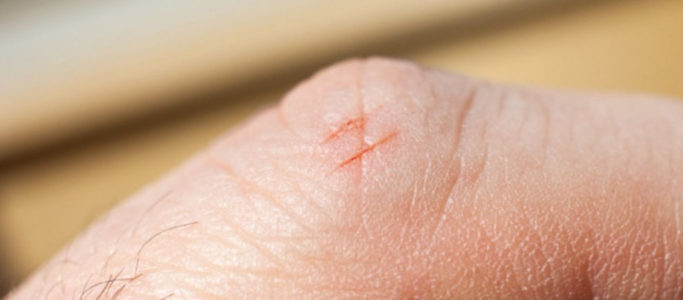 Αυτός είναι ο λόγος που το κόψιμο από χαρτί πονάει περισσότερο από άλλα