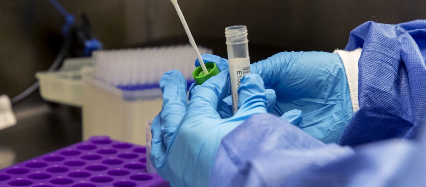 Νέα έρευνα: «Τοξικά» αντισώματα ύστερα από ήπιο κορωνοϊό επιτίθενται στον οργανισμό και προκαλούν μακρά Covid!