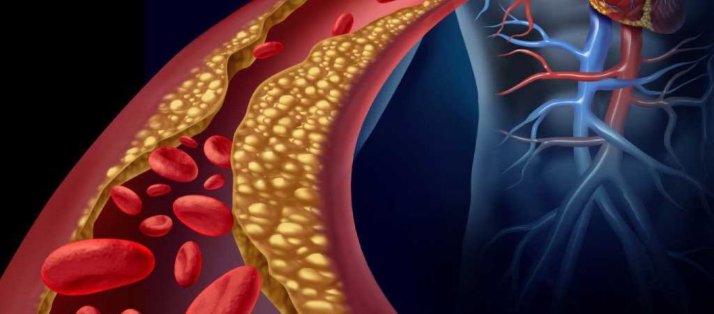 Ο «θαυματουργός» χυμός που βοηθά να μειώσετε την χοληστερόλη