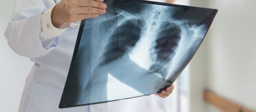 Τήνος: Τον έστειλαν για ακτινογραφία στο… κτηνιατρείο