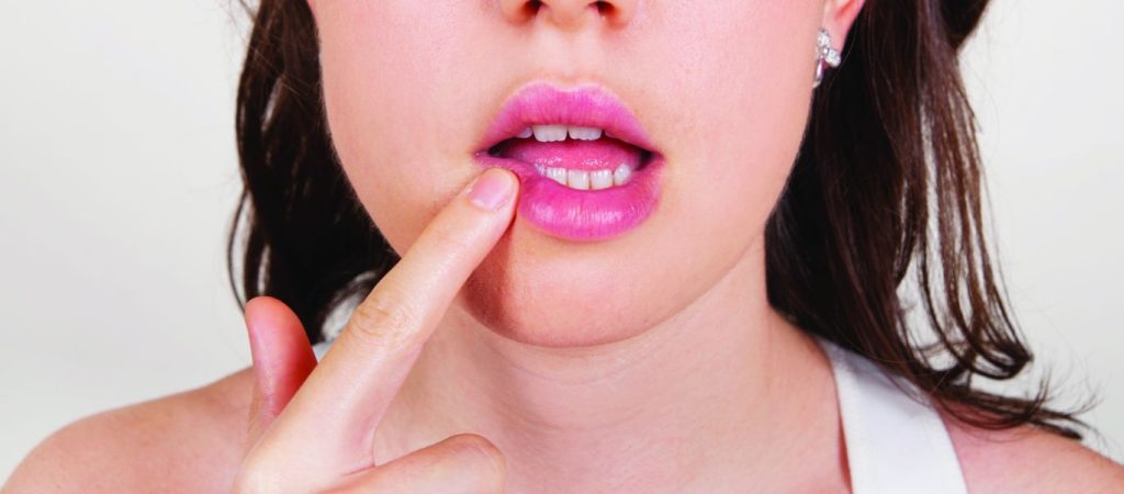 Οι φυσικοί τρόποι για να αντιμετωπίσετε τον επιχείλιο έρπη