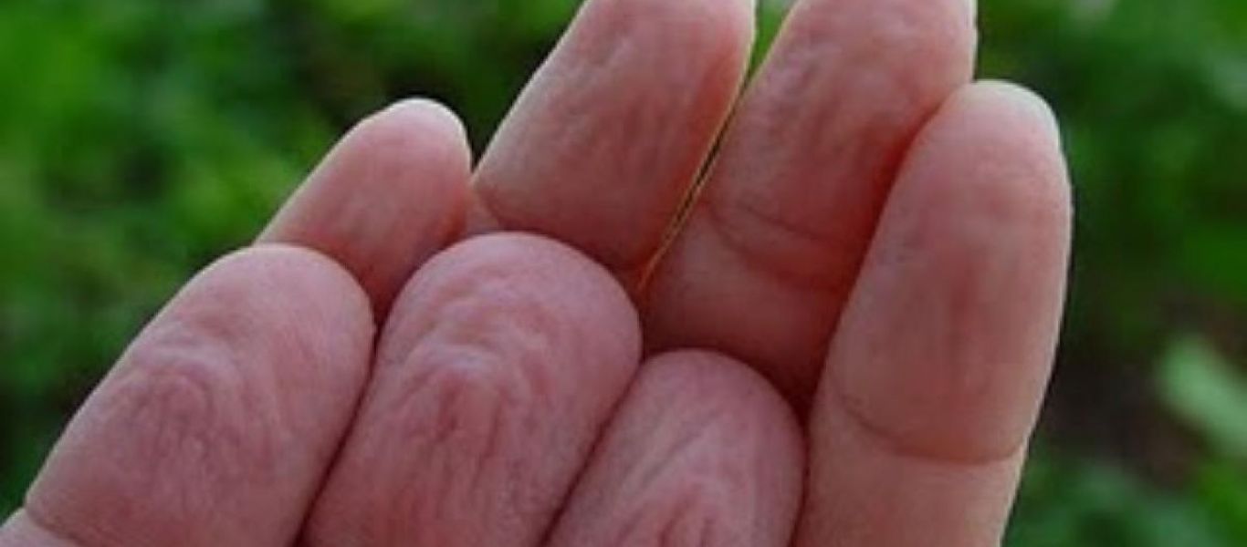 Έχετε αναρωτηθεί; – Πού οφείλονται τα ζαρωμένα δάχτυλα μετά το μπάνιο;