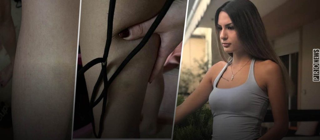 Βιασμός 24χρονης: Στη δημοσιότητα φωτογραφίες από την κακοποίησή της