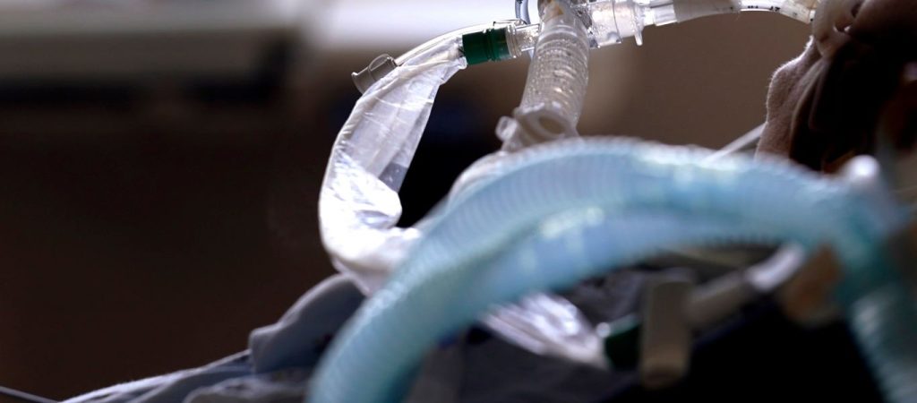 Νέα έρευνα: Η αναμονή πάνω από πέντε ώρες στα επείγοντα του νοσοκομείου μπορεί και να σκοτώσει!