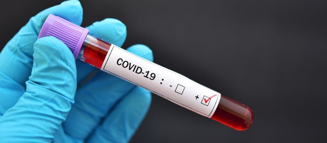 Κορωνοϊός: Επιστήμονες δημιουργούν νέο PCR test που ανιχνεύει τις μεταλλάξεις – Πώς θα λειτουργεί