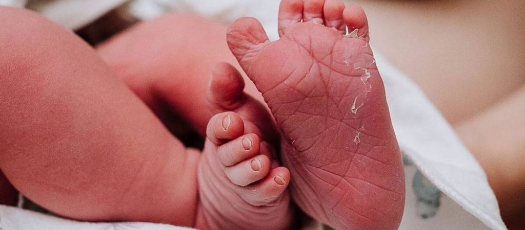 Τι πρέπει να γνωρίζετε για το αντανακλαστικό Babinski στα μωρά;