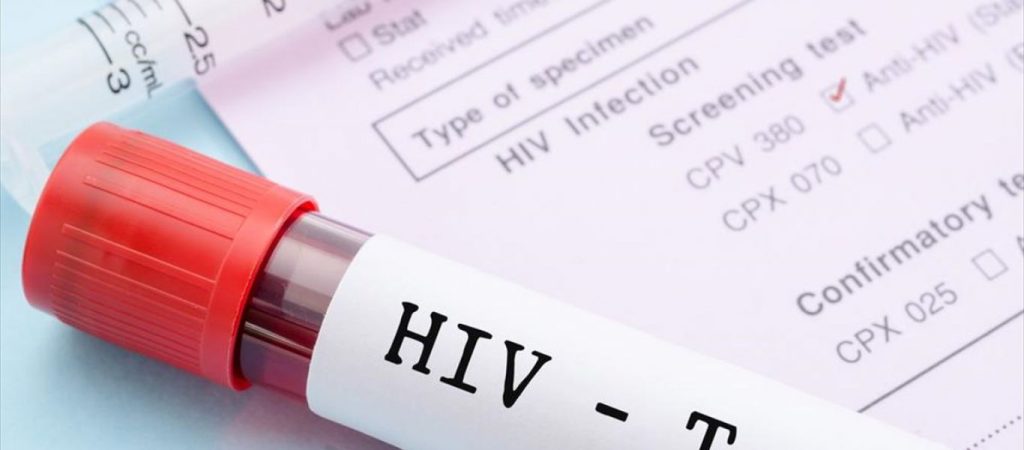 Ιταλία: 58χρονος άνδρας οδηγείται στην φυλακή για τον θάνατο 4 γυναικών που μόλυνε με τον ιό του AIDS