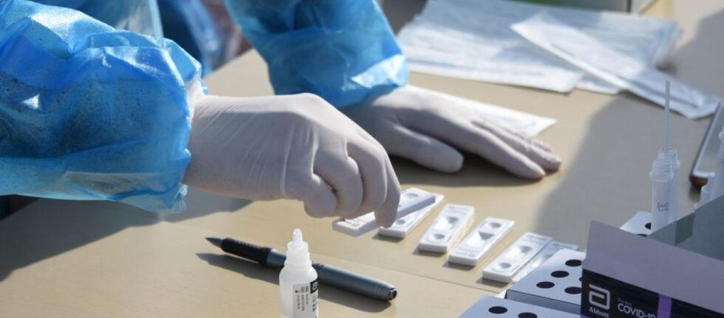 ΕΟΔΥ: Δείτε που θα πραγματοποιούνται δωρεάν rapid test σήμερα