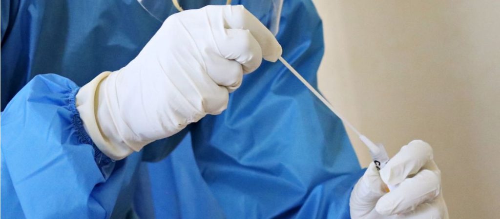 ΕΟΔΥ: Δείτε που θα πραγματοποιούνται δωρεάν rapid test σήμερα
