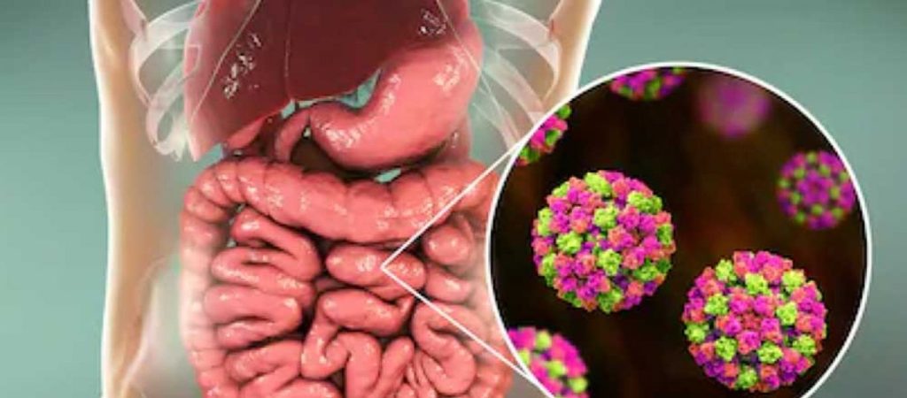 Γαστρεντερίτιδα και διατροφή: Οι πρώτες κινήσεις που πρέπει να κάνετε – Πότε πρέπει να πάτε στον γιατρό