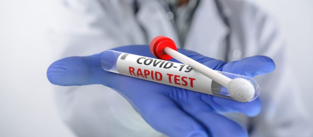 ΕΟΔΥ: Δείτε σε ποιες περιοχές μπορείτε να κάνετε αύριο δωρεάν rapid test