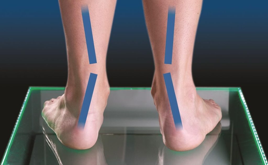 Ένιωθε «ηλεκτρικά κύματα» στα πόδια της – Αποδείχτηκε ότι υπήρχε μια απίστευτη και σοβαρή αιτία