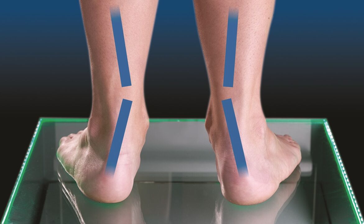 Ένιωθε «ηλεκτρικά κύματα» στα πόδια της – Αποδείχτηκε ότι υπήρχε μια απίστευτη και σοβαρή αιτία