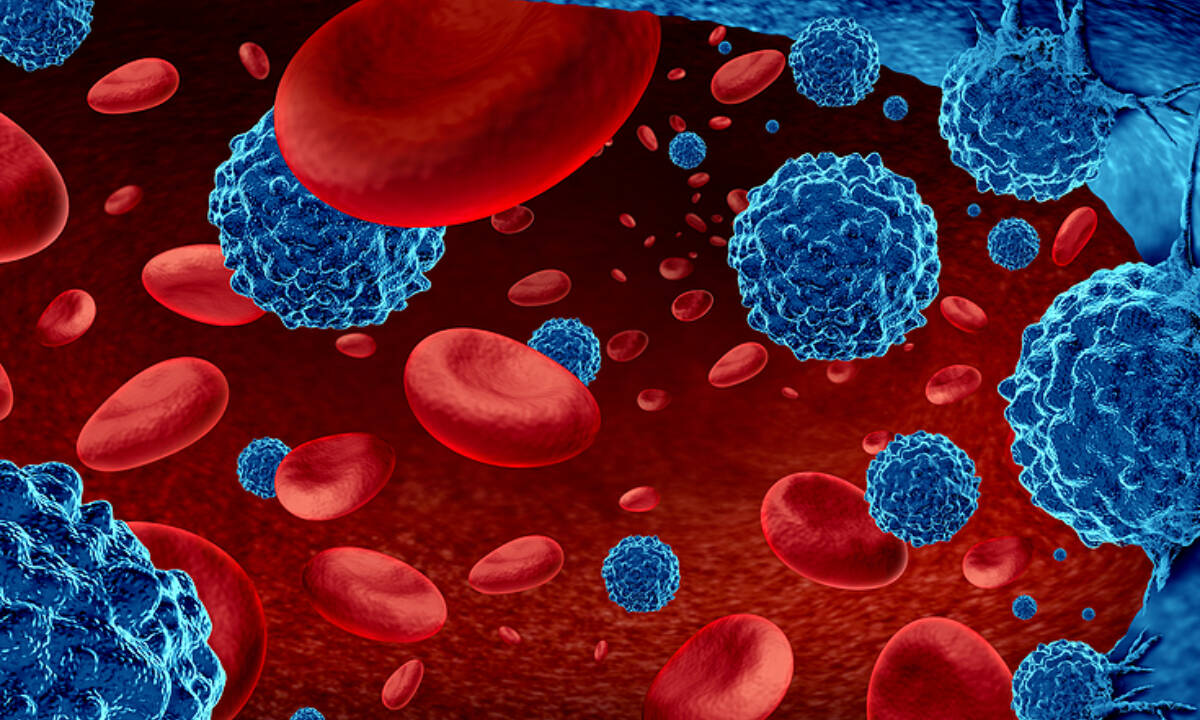 Λέμφωμα: Τα συμπτώματα που δεν πρέπει να αγνοήσετε