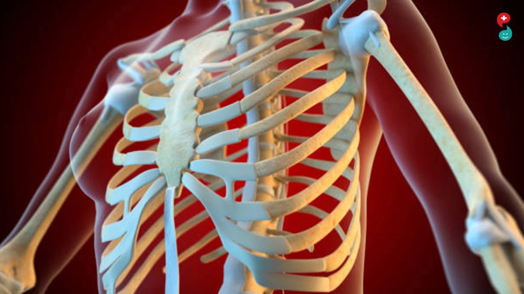 Πλευροχονδρίτιδα: Αιτίες, συμπτώματα και αντιμετώπιση – Όλα όσα πρέπει να ξέρεις